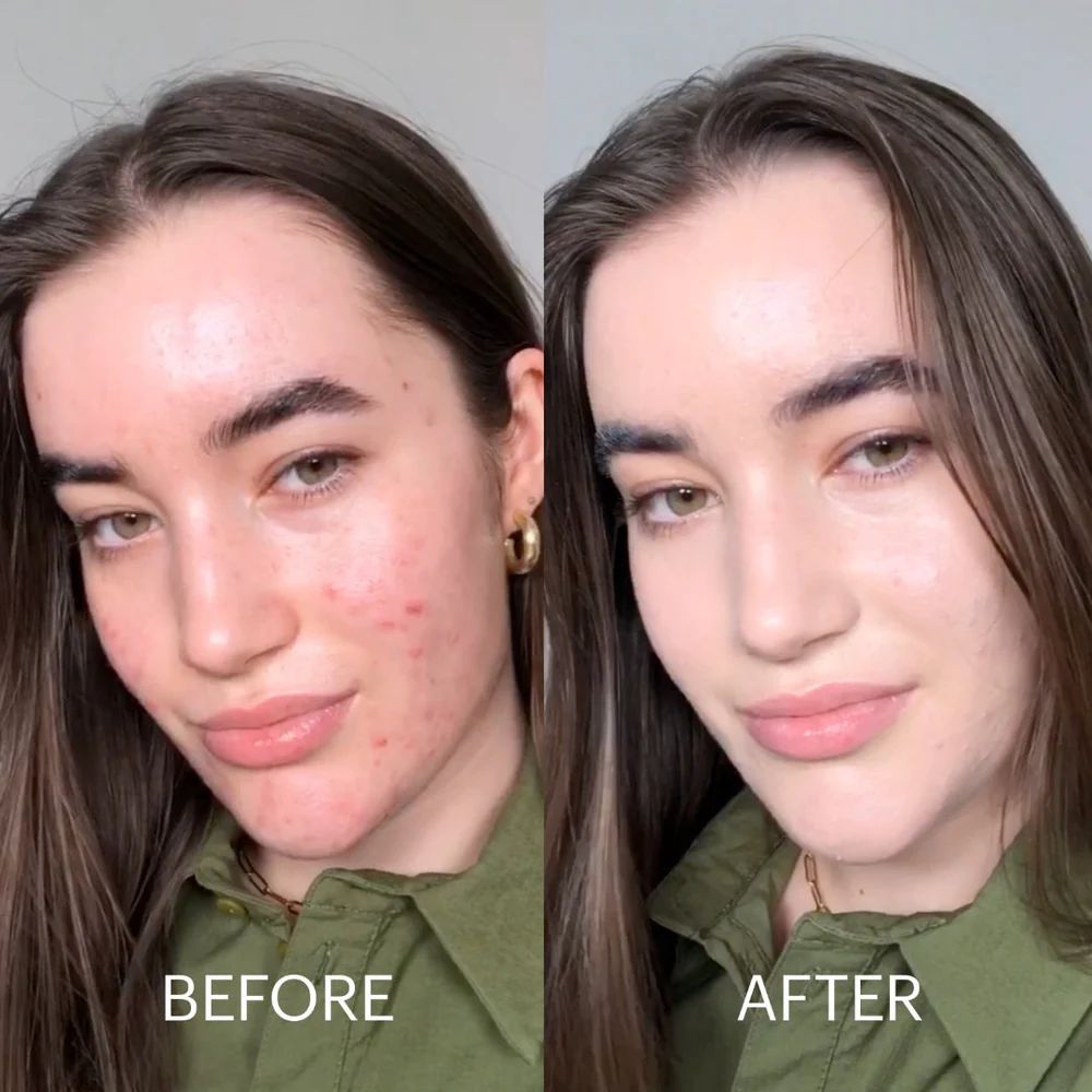 Dr. Jart Cicapair™ Tiger Grass Color Correcting Treatment SPF 30